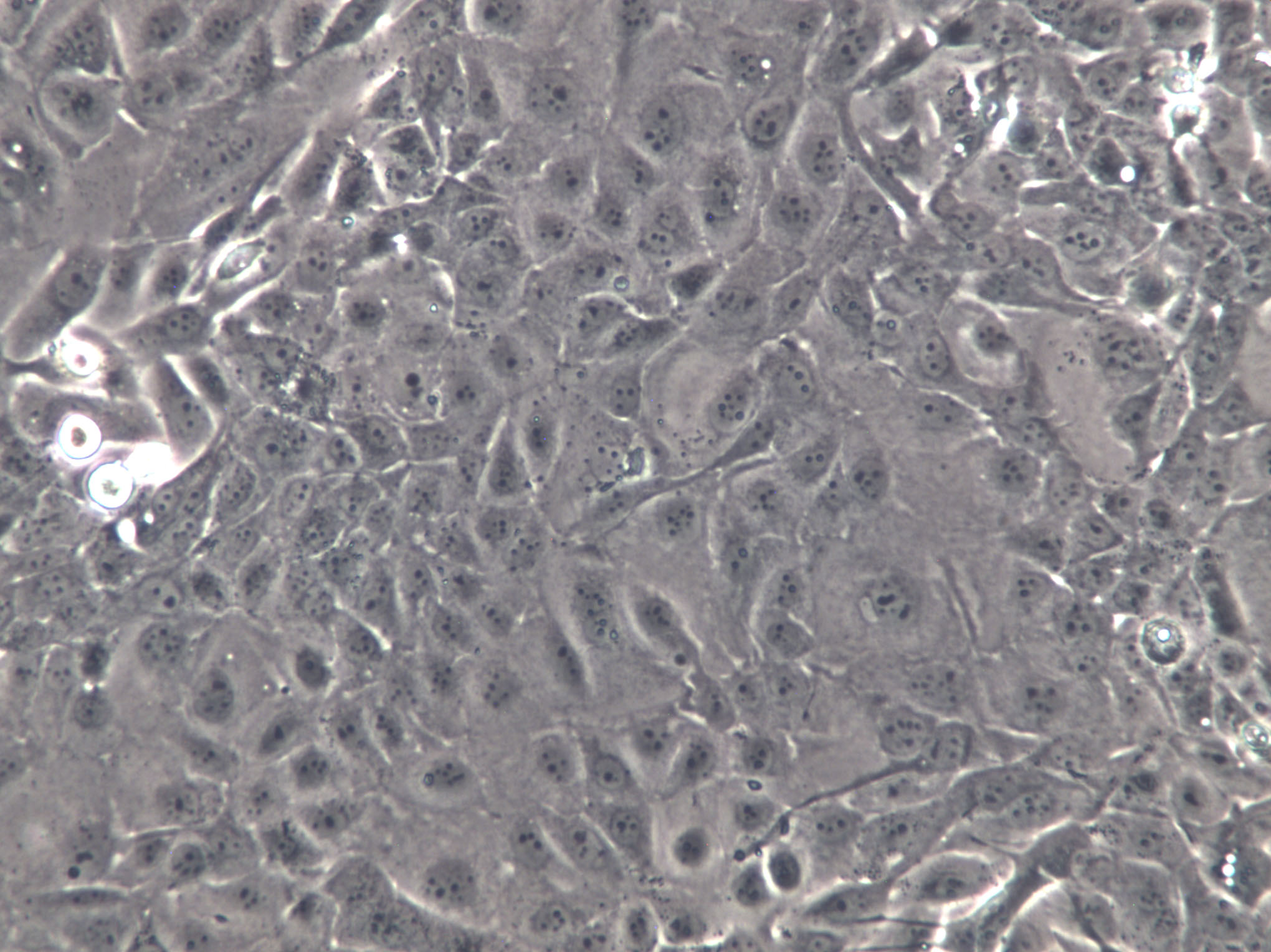 hCMEC/D3 Cells(赠送Str鉴定报告)|永生化人脑微血管内皮细胞