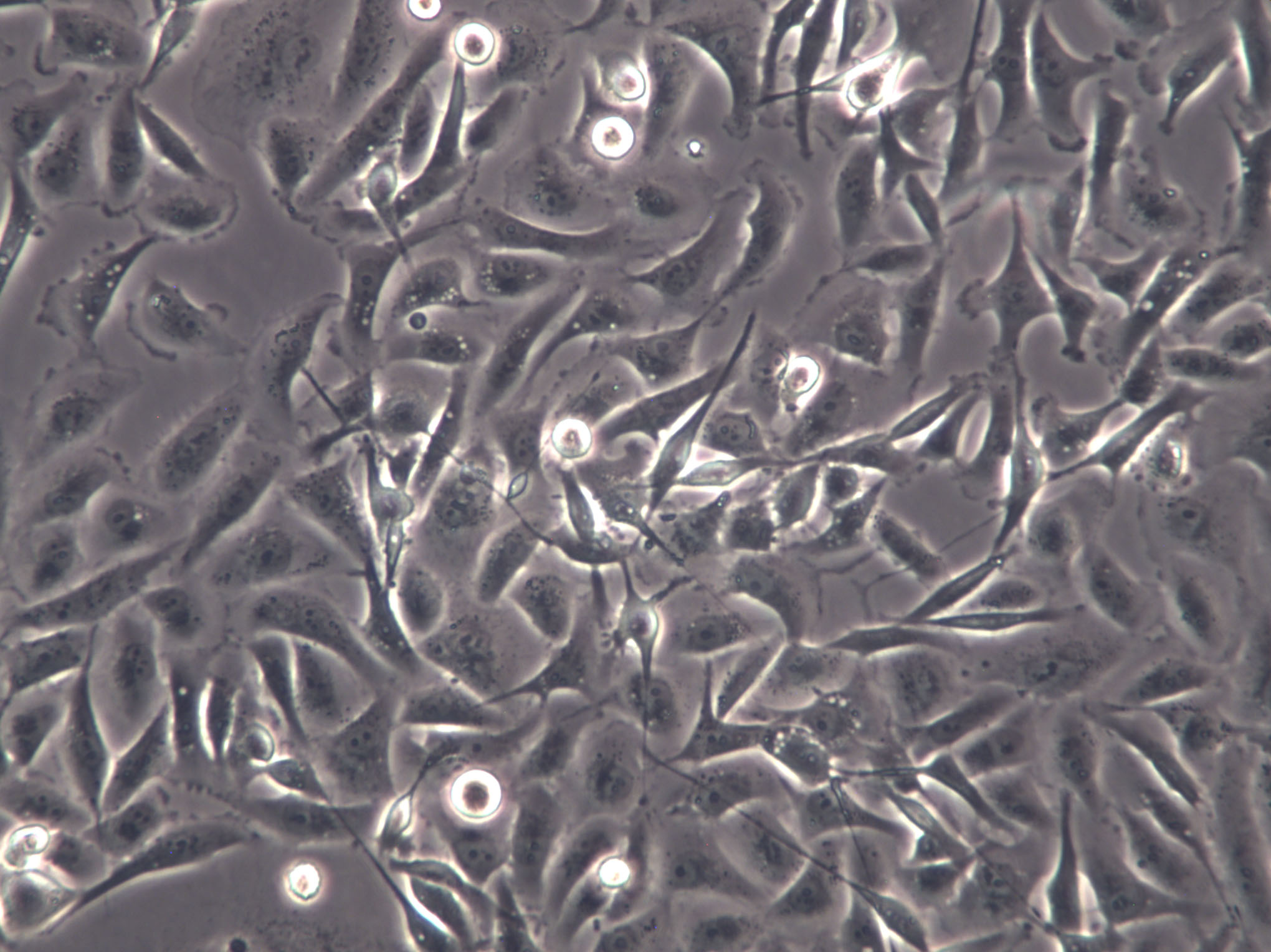 MDA-MB-435 Cells|人乳腺癌克隆细胞