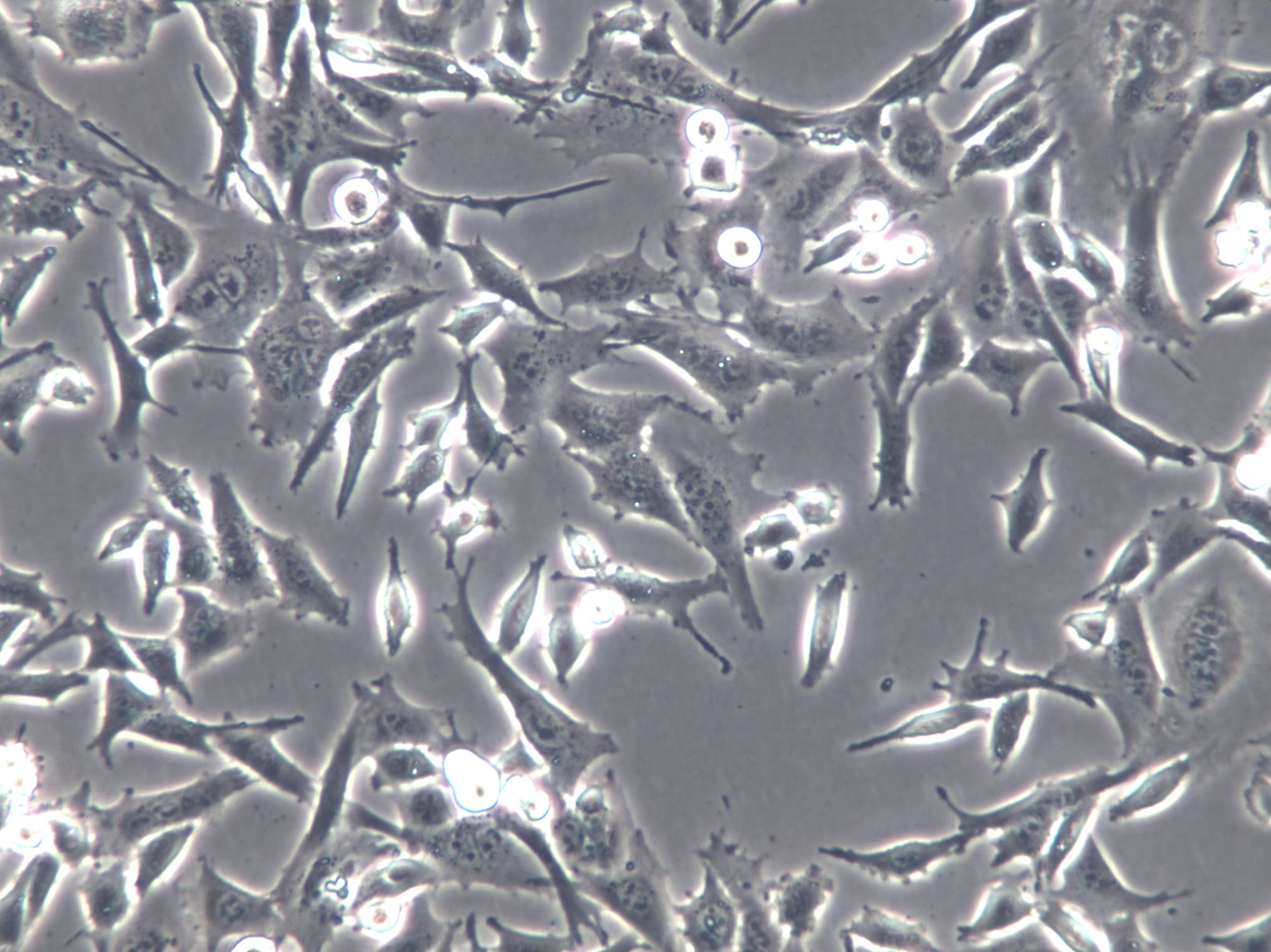 RF/6A Cells(赠送Str鉴定报告)|猴脉络膜-视网膜(内皮)细胞