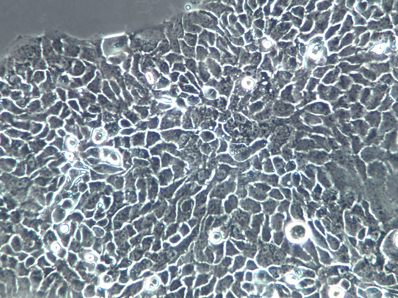 SV40 MES 13 Cells(赠送Str鉴定报告)|小鼠肾小球系膜细胞