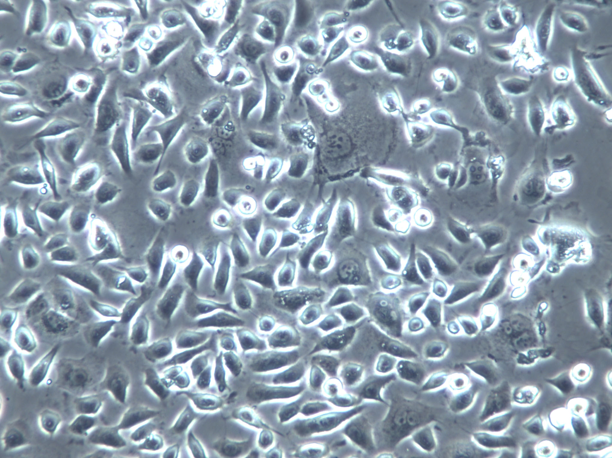 CHL Cells(赠送Str鉴定报告)|中国仓鼠肺细胞
