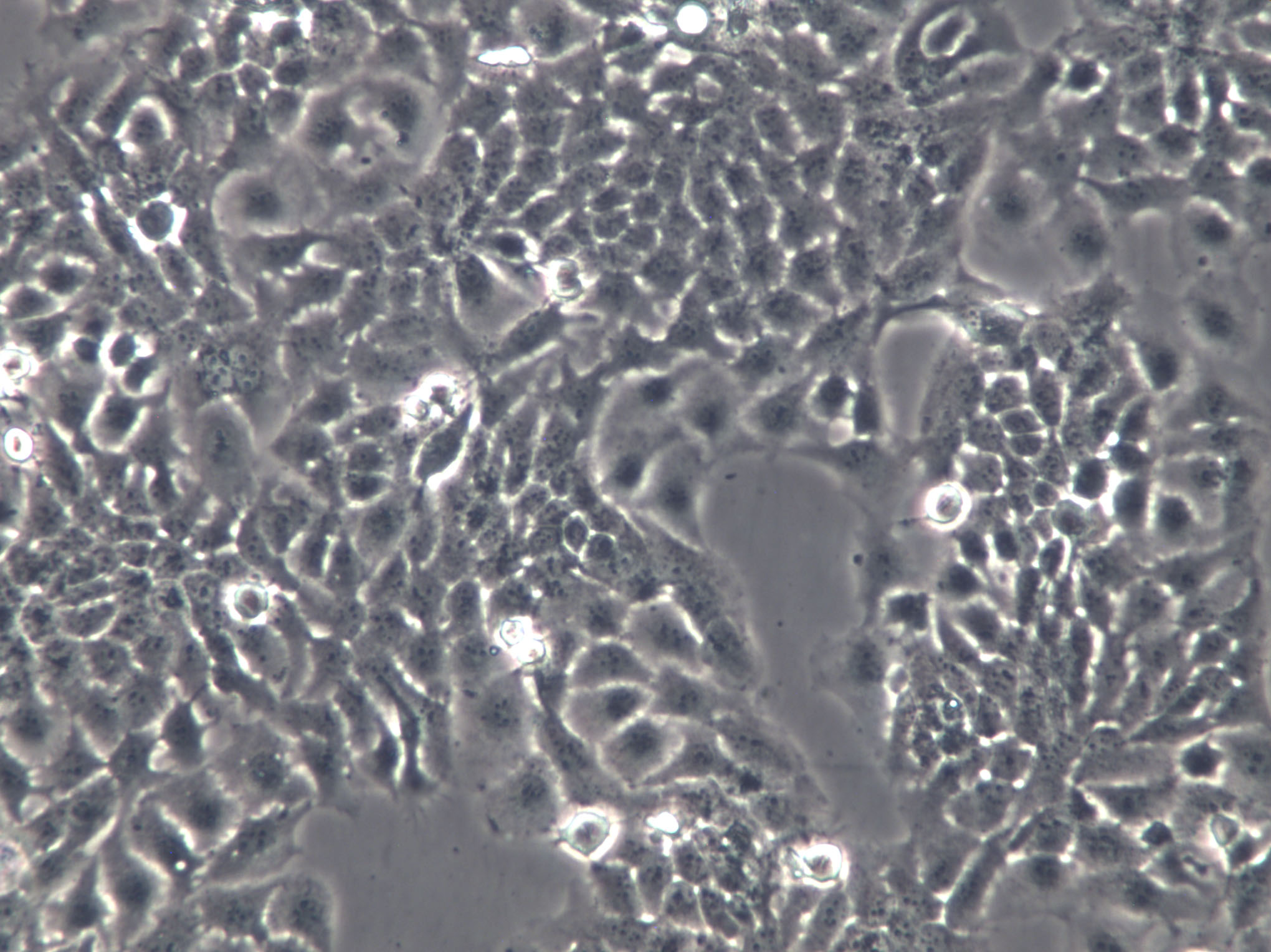 NCI-H345 Cells|人小细胞肺癌克隆细胞