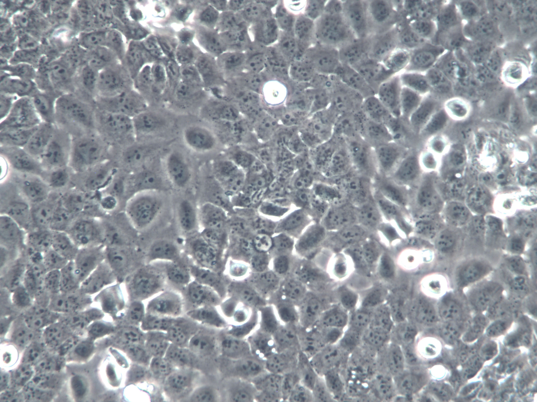 H22 Cells(赠送Str鉴定报告)|小鼠肝癌细胞