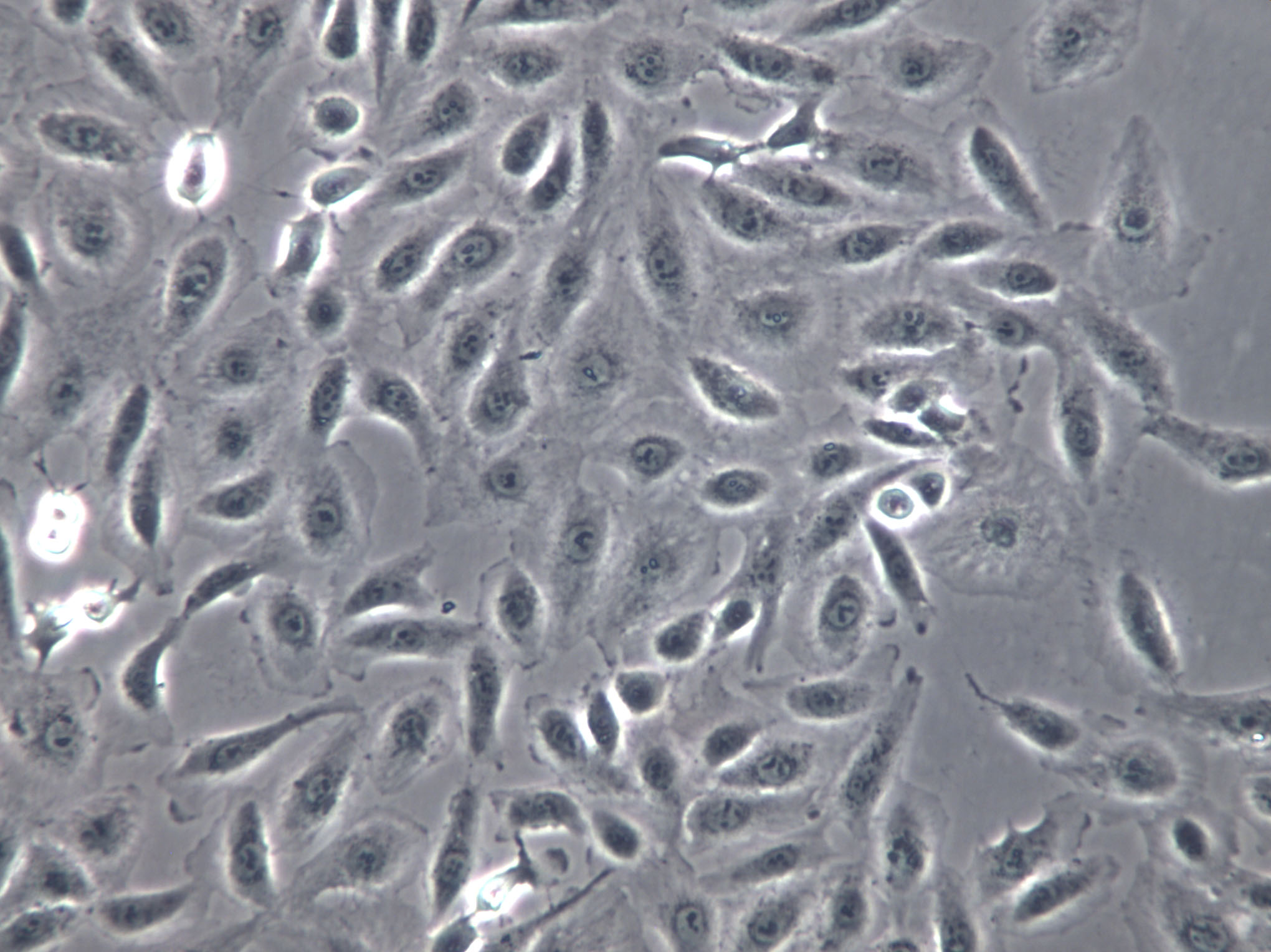 KYSE-140 Cells|人食管鳞癌克隆细胞