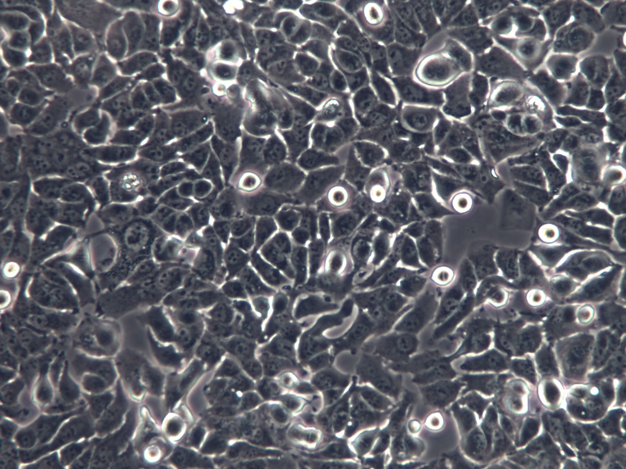 SK-OV-3 Cells(赠送Str鉴定报告)|人卵巢癌细胞