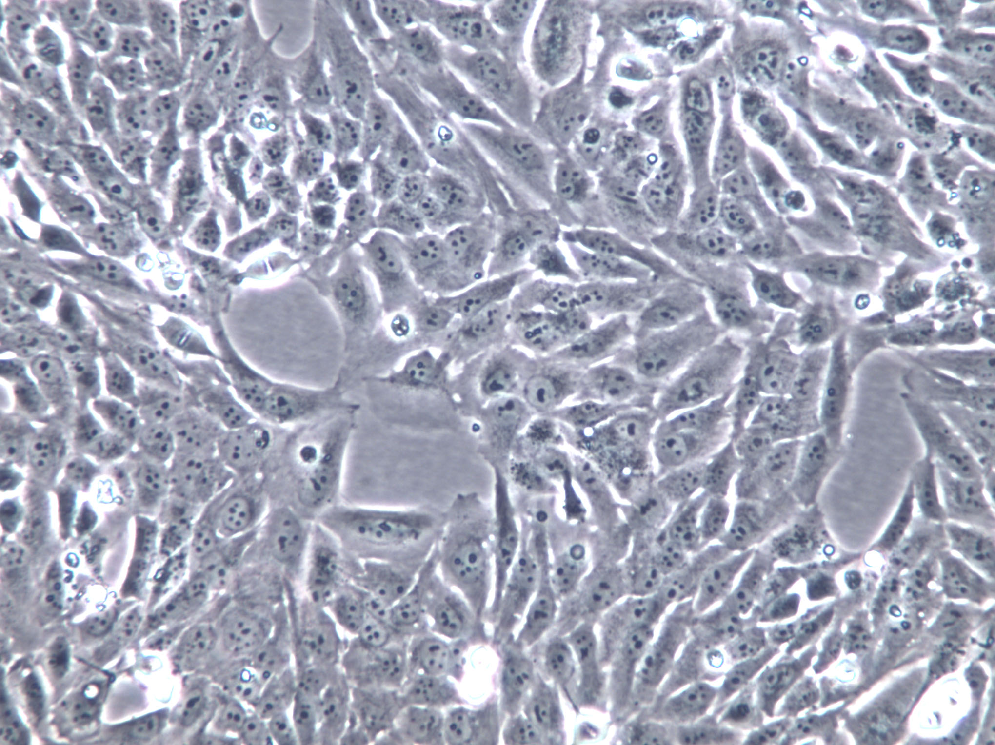 C666-1 Cells(赠送Str鉴定报告)|人鼻咽癌细胞