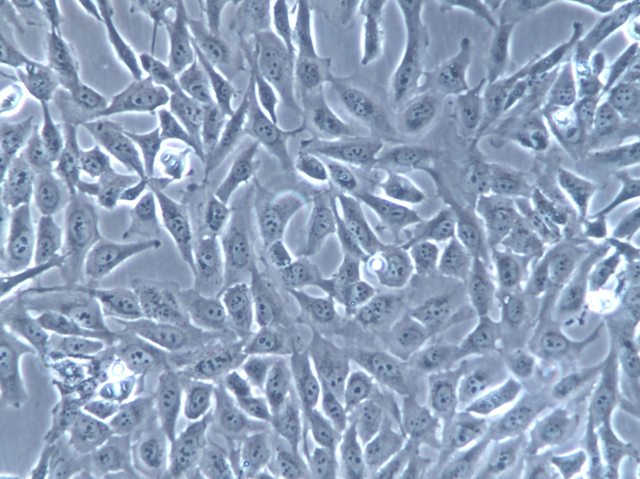 Li-7 Cells(赠送Str鉴定报告)|人肝癌细胞