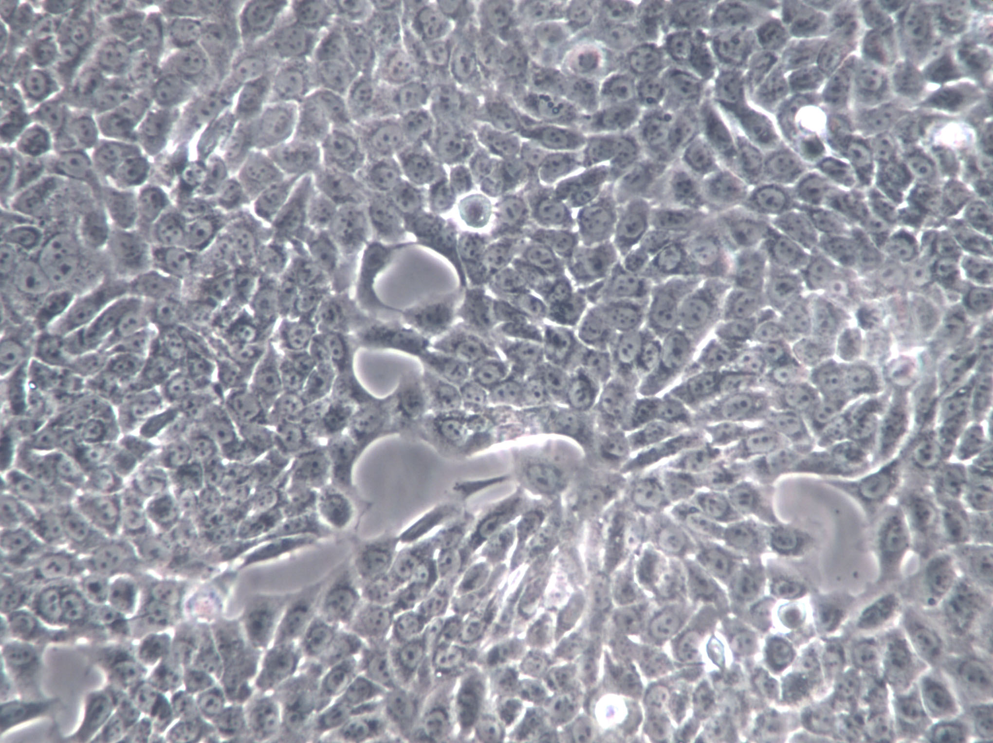 SPC-A1 Cells|人肺腺癌克隆细胞