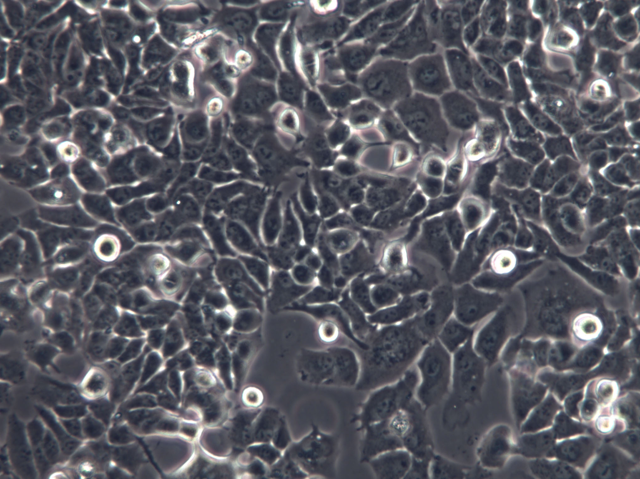 COLO 394 Cells|人结肠癌克隆细胞