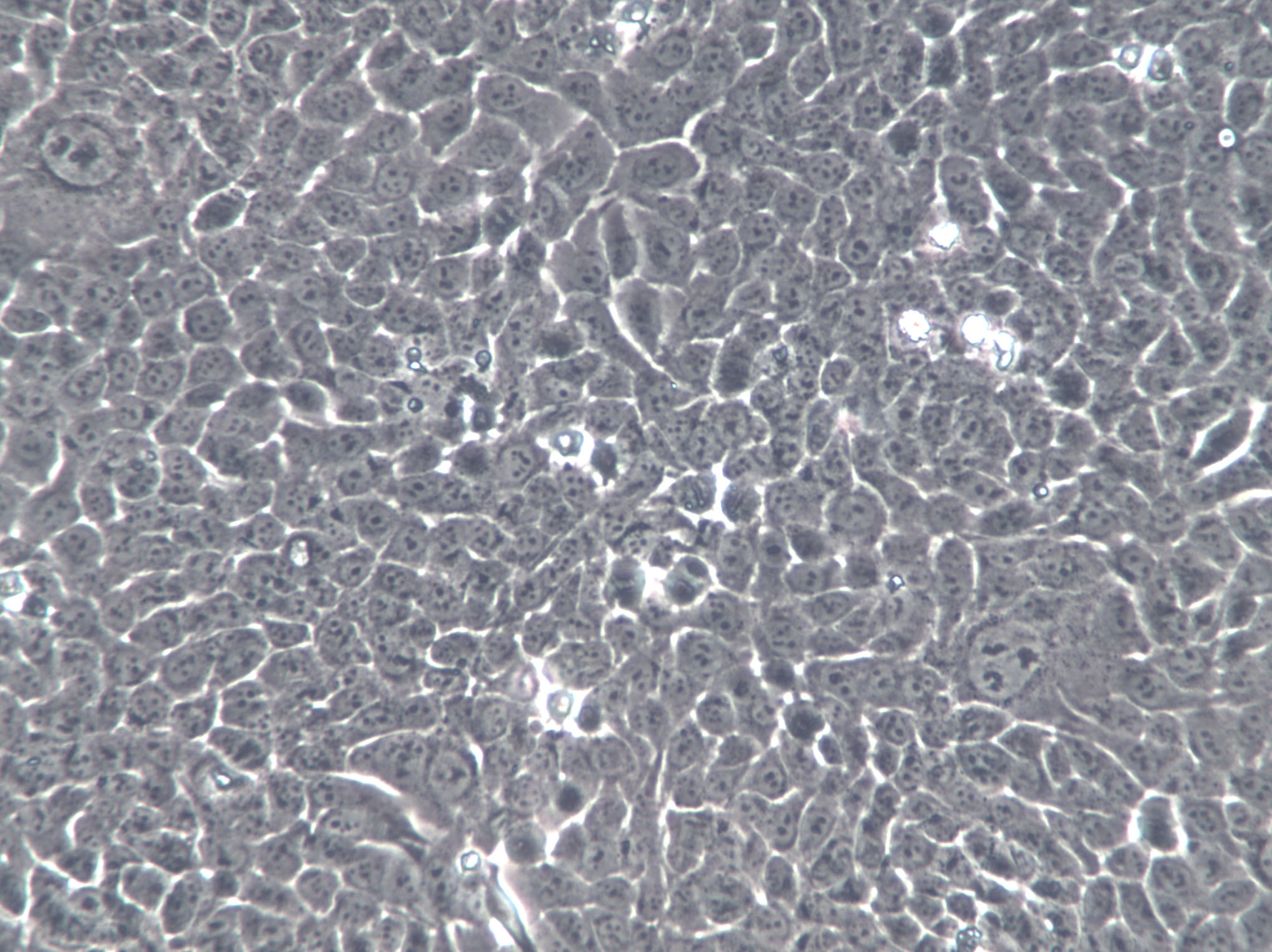 SV-HUC-1 Cells(赠送Str鉴定报告)|人膀胱上皮永生化细胞