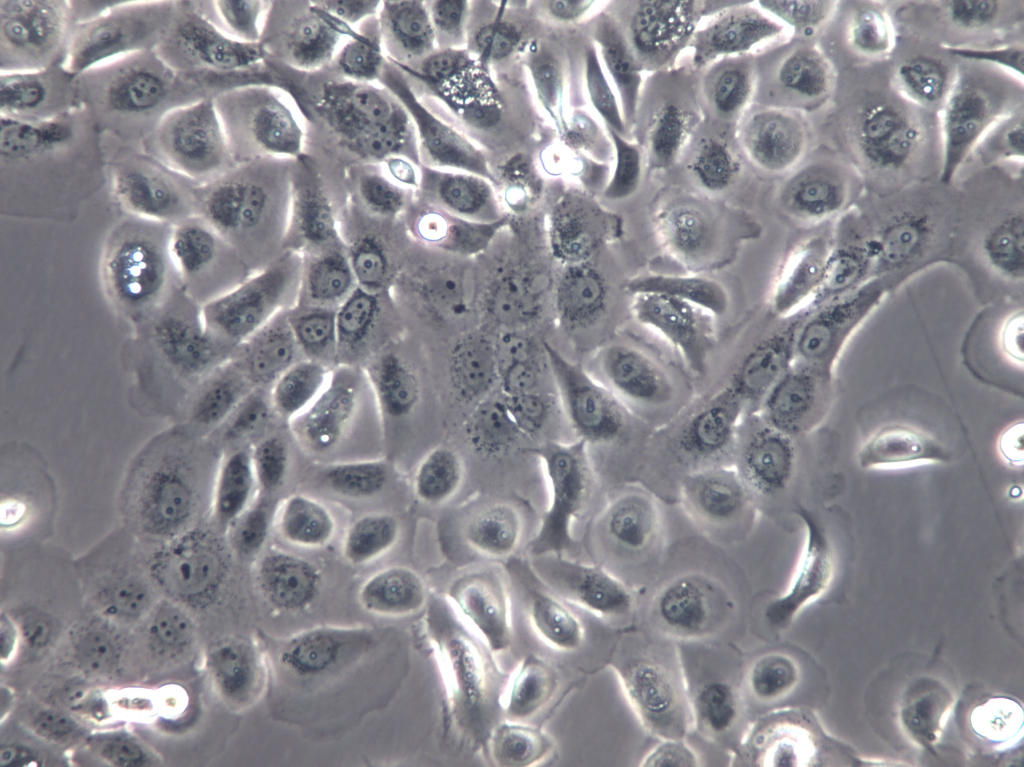 ID8 Cells(赠送Str鉴定报告)|小鼠卵巢癌细胞