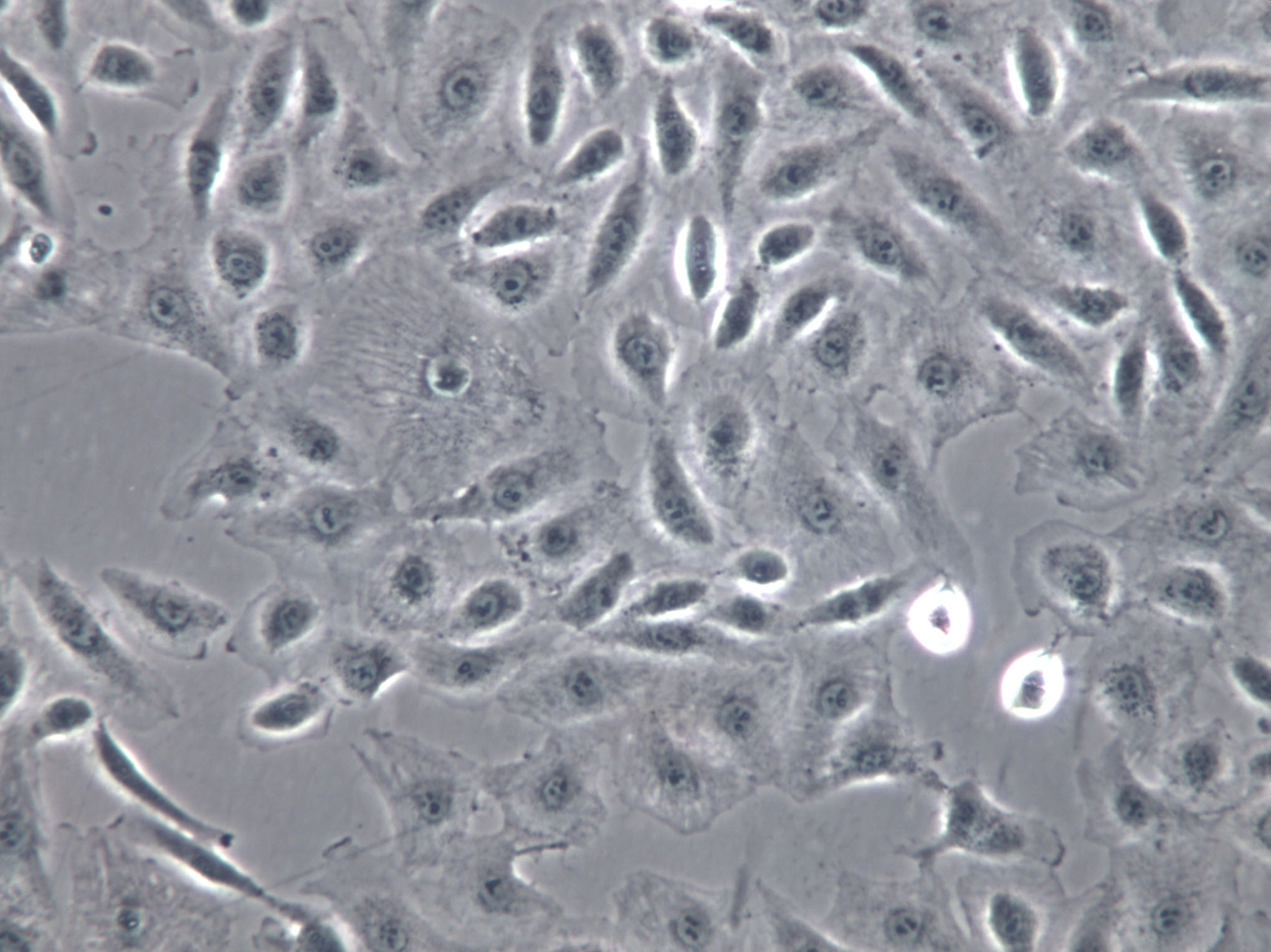 SNU-601 Cells|人胃癌克隆细胞