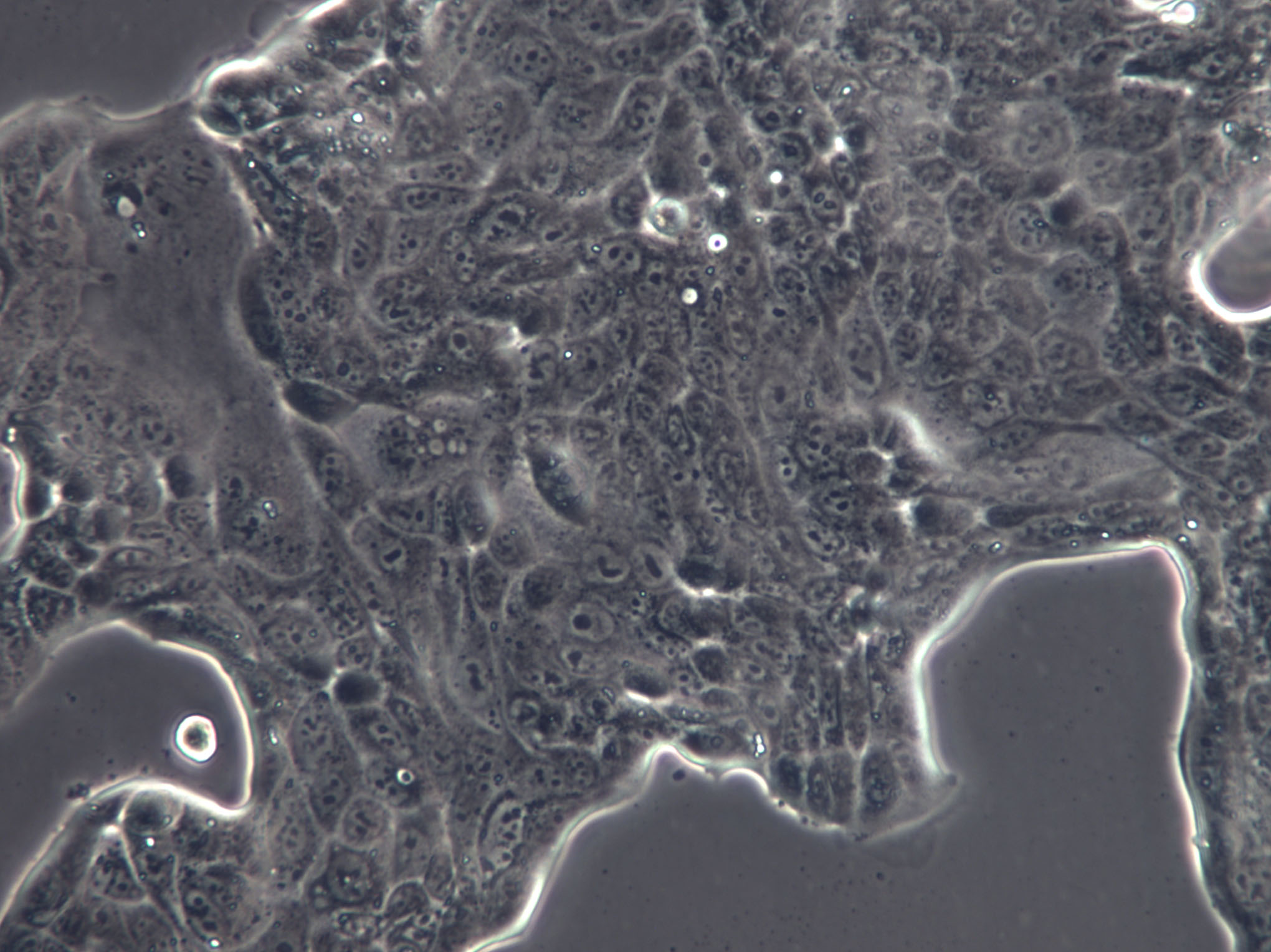 MGH-U3 Cells|人膀胱癌克隆细胞