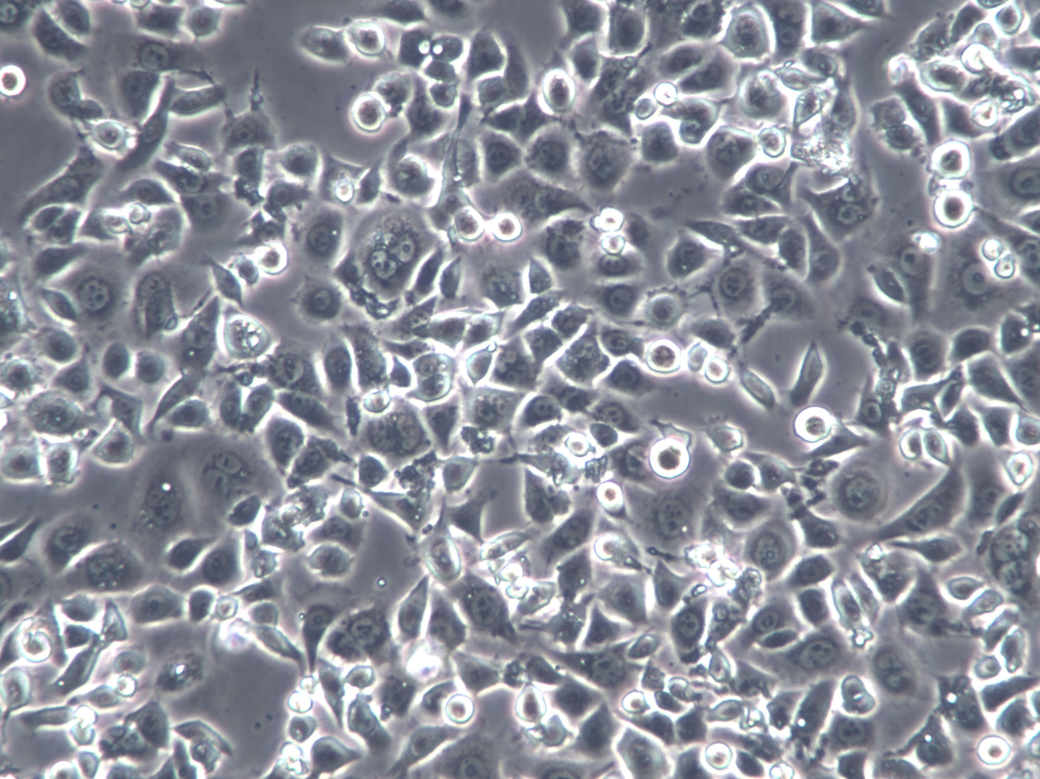IMR-90 Cells|人胚肺成纤维克隆细胞