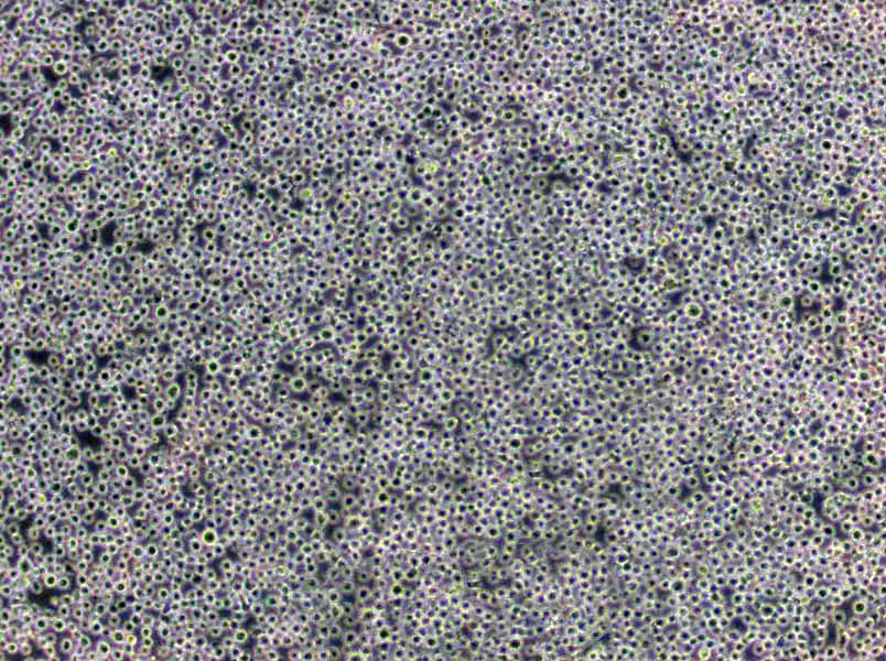 UT-7 Cells|人类原巨核细胞型白血病克隆细胞