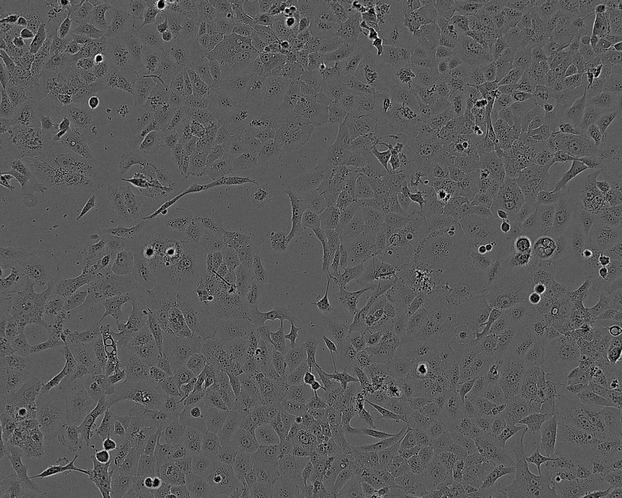 Caki-2 Cells|人肾透明细胞癌需消化细胞系