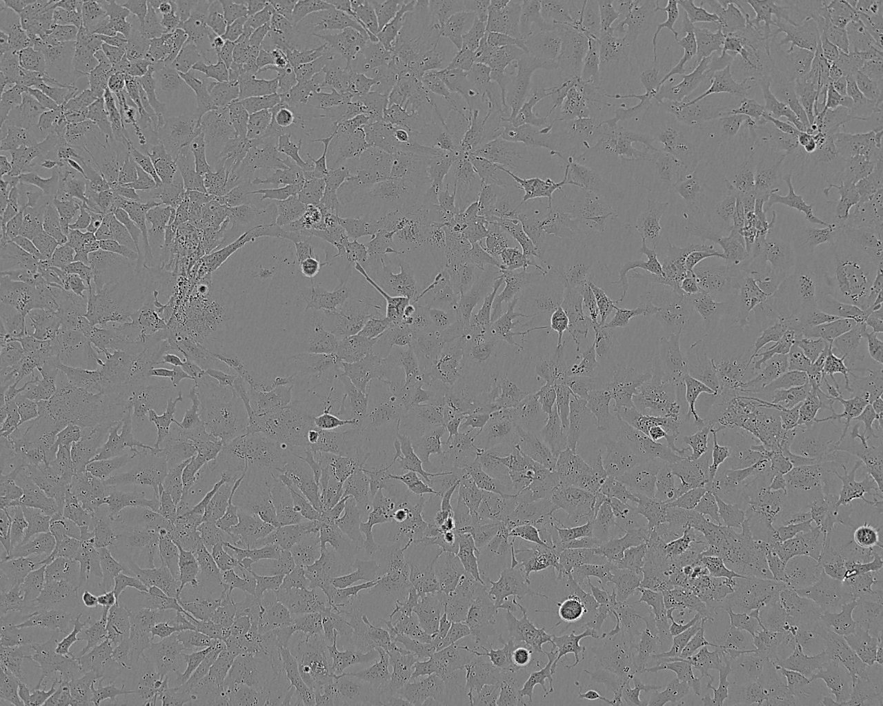 RKN Cells(赠送Str鉴定报告)|人卵巢癌细胞