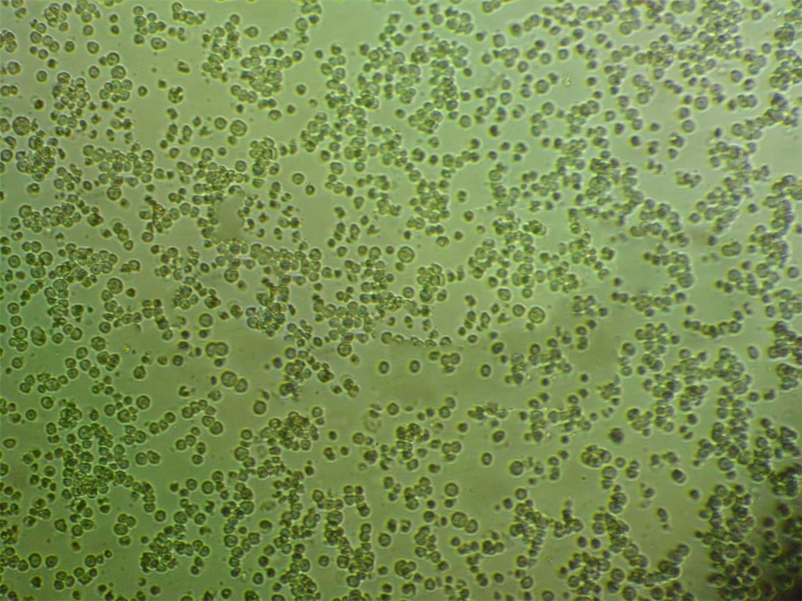 SU-DHL-1 Cells|人间变性大细胞淋巴瘤可传代细胞系