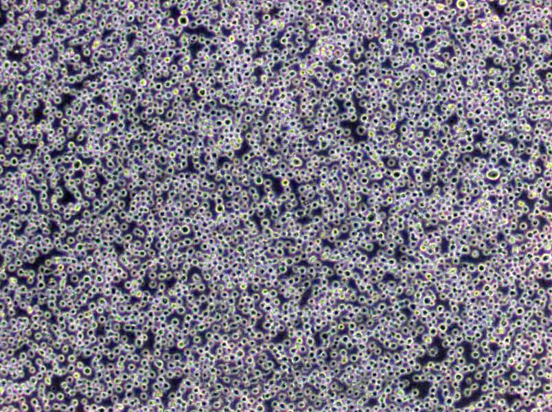 BA/F3 Cells|小鼠原B需消化细胞系