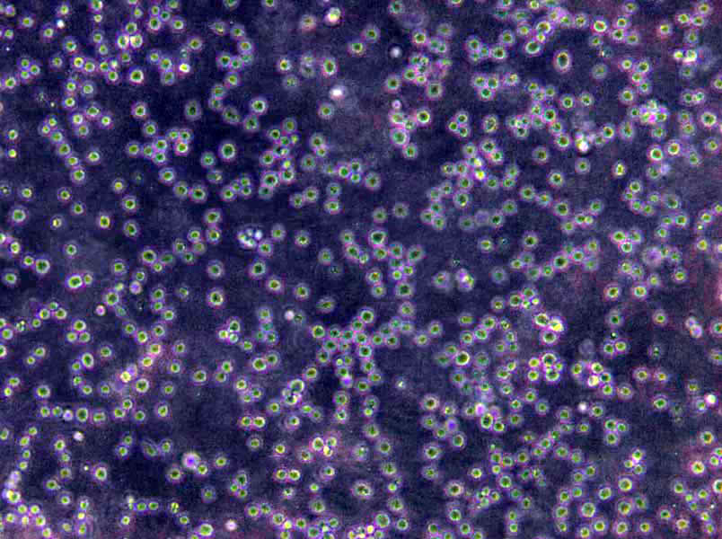 NCM356 Cells|结直肠腺癌需消化细胞系