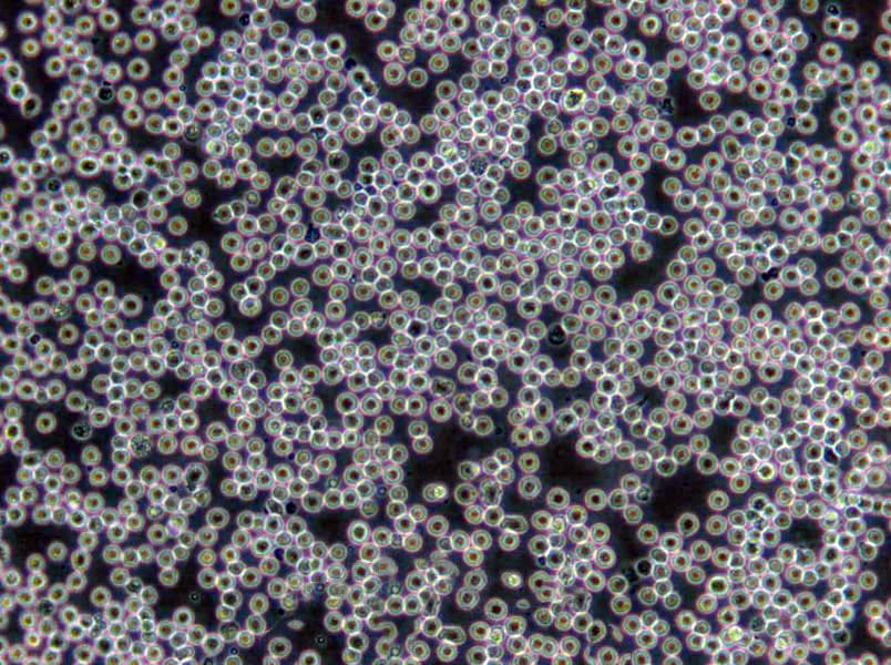 CAL-39 Cells|外阴鳞癌需消化细胞系