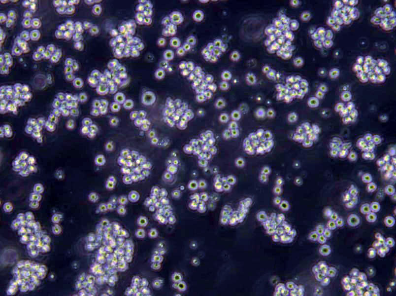 NCI-H2171 Cells(赠送Str鉴定报告)|人小细胞肺癌细胞