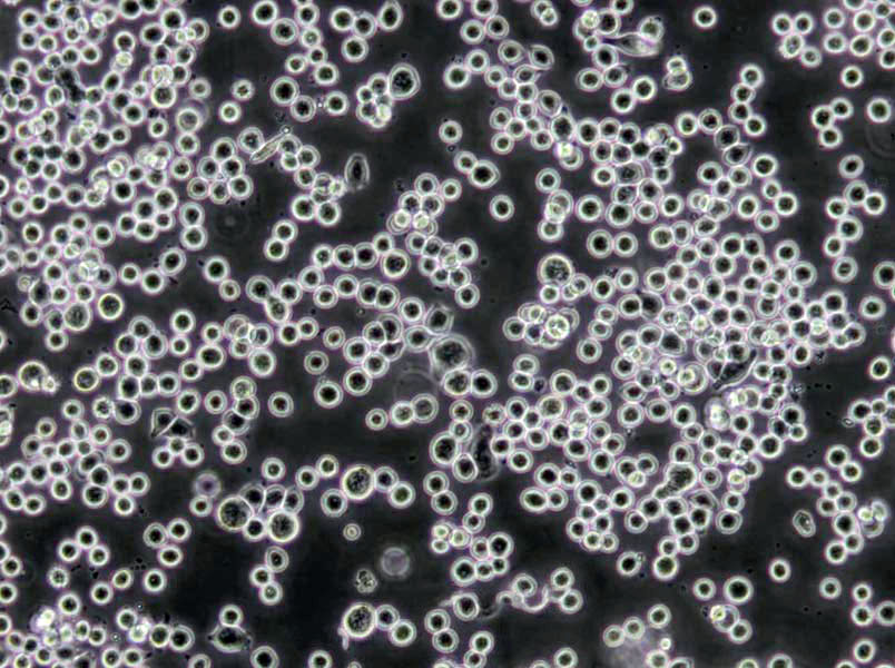 SW1783 Cells|脑星形胶质瘤需消化细胞系