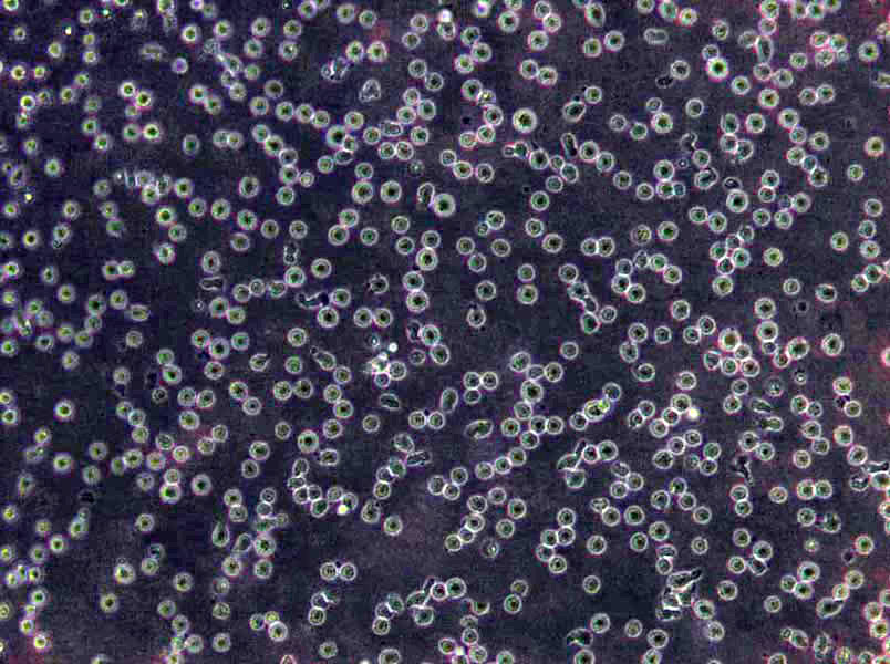 HuLEC-5a Cells|肺微血管内皮需消化细胞系