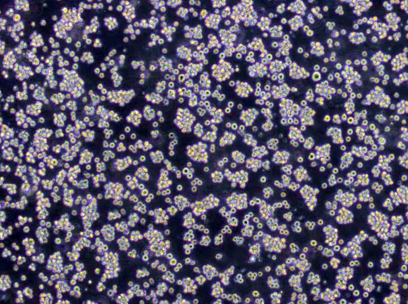 COR-L51 Cells|肺癌需消化细胞系