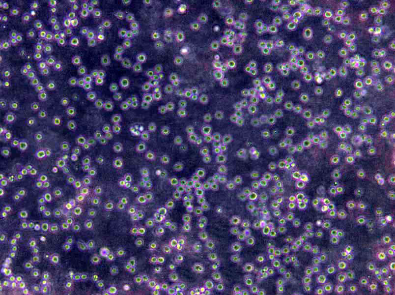 NCI-H1963 Cells(赠送Str鉴定报告)|人小细胞肺癌细胞