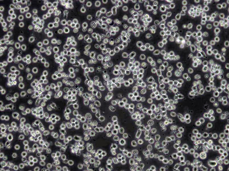 NCI-H727 Cells(赠送Str鉴定报告)|人肺支气管良性肿瘤细胞