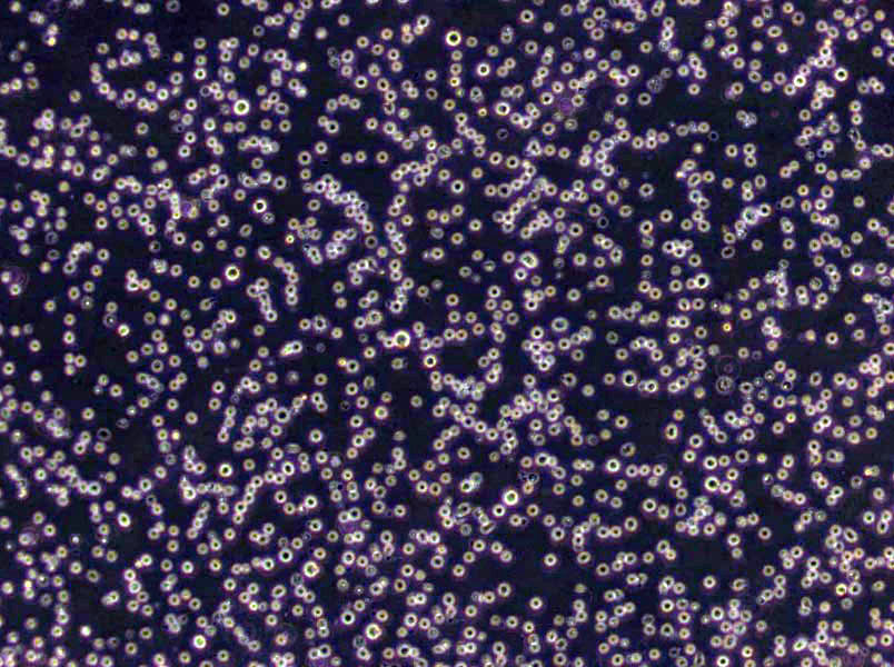 NCI-H2444 Cells(赠送Str鉴定报告)|人非小细胞肺癌细胞