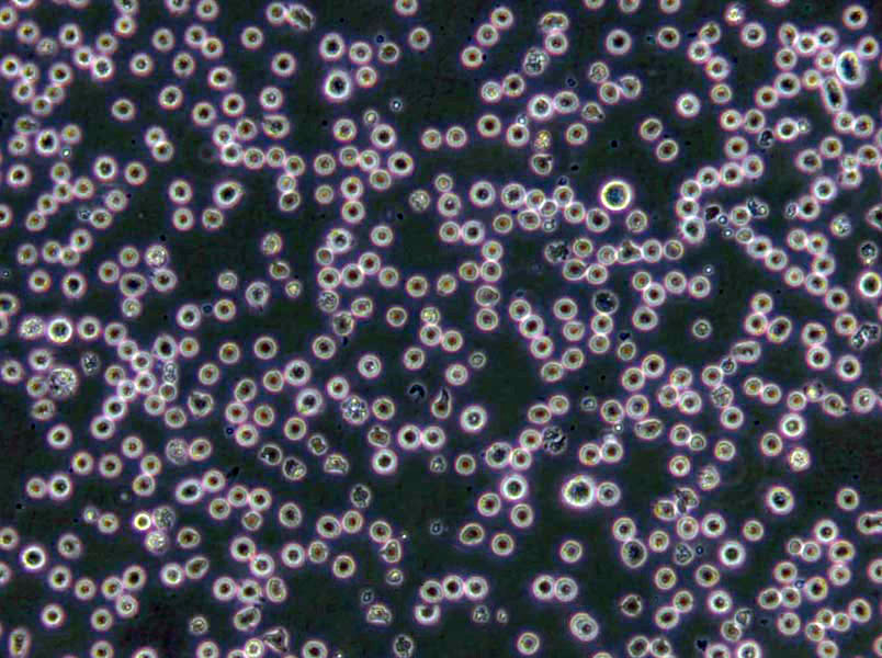 NCI-H2106 Cells(赠送Str鉴定报告)|人非小细胞肺癌细胞