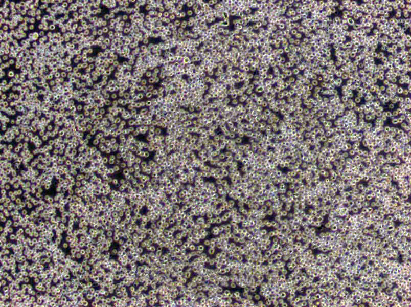 NCI-H1373 Cells(赠送Str鉴定报告)|人肺癌腺癌细胞