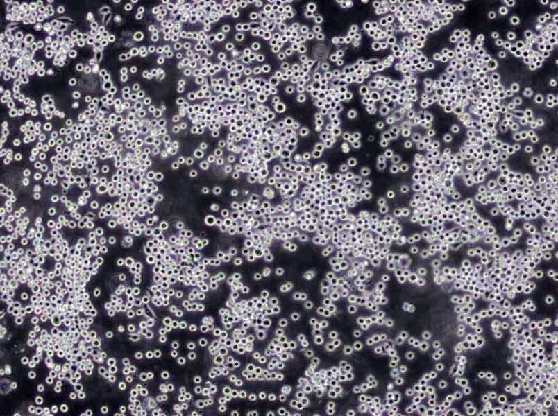 RERF-LC-MS Cells(赠送Str鉴定报告)|人肺癌腺癌细胞