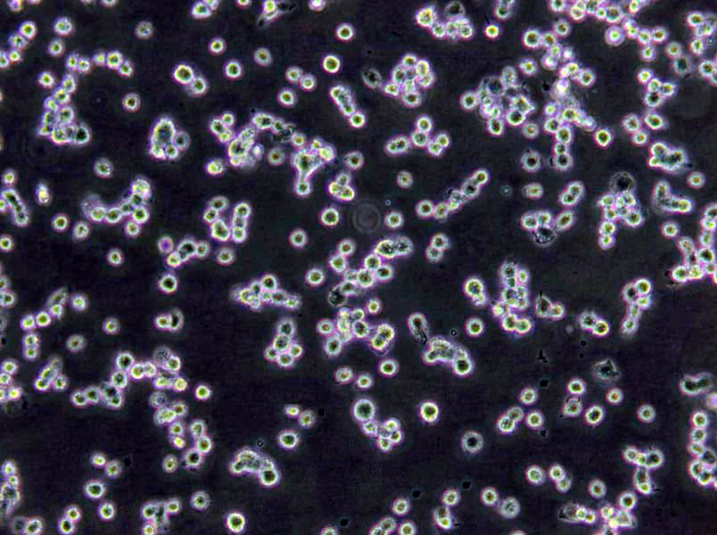 LS411N Cells(赠送Str鉴定报告)|人盲肠癌细胞