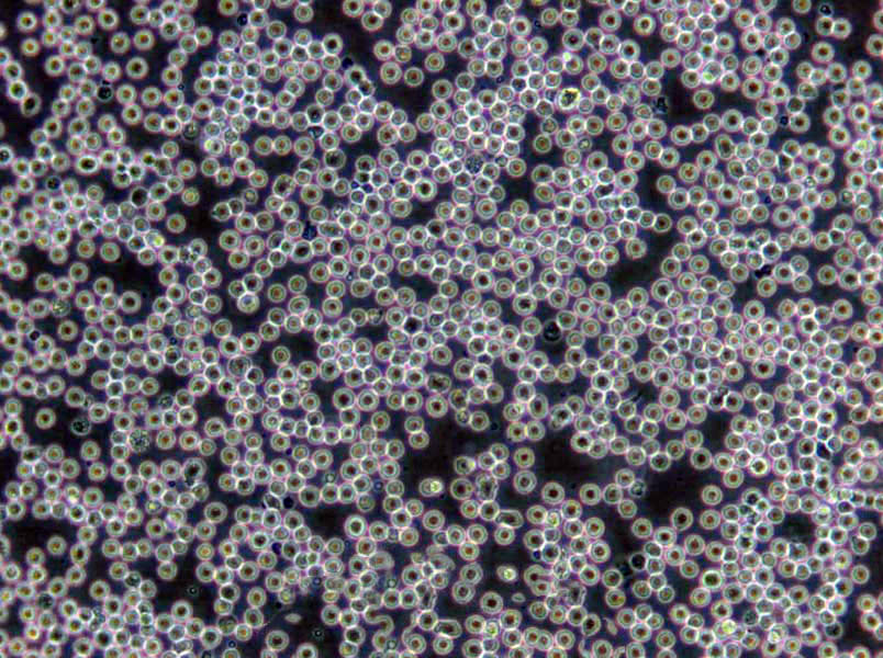 LS513 Cells(赠送Str鉴定报告)|人盲肠癌细胞