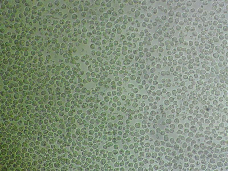 HuH-6 Cell肝母细胞瘤传代培养