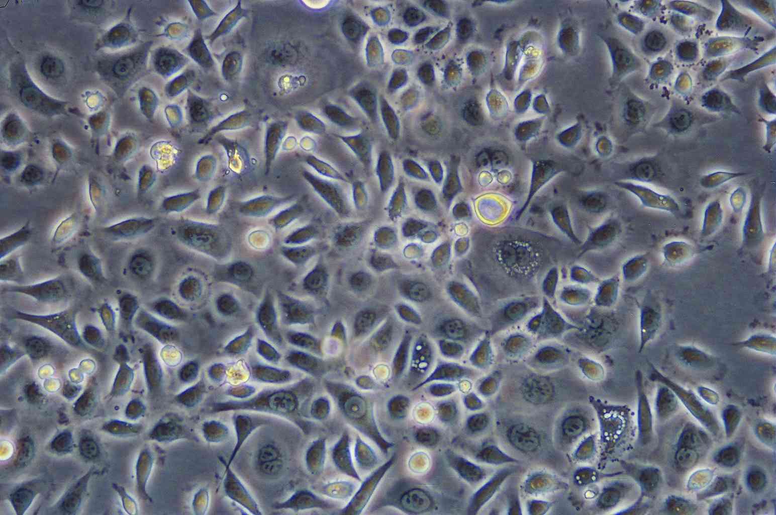 SCC7小鼠鳞状细胞癌复苏细胞(附STR鉴定报告)