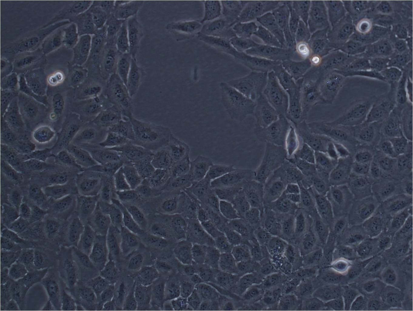 FHL124人晶状体上皮复苏细胞(附STR鉴定报告)
