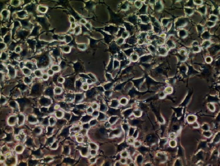 MKN74人胃癌复苏细胞(附STR鉴定报告)