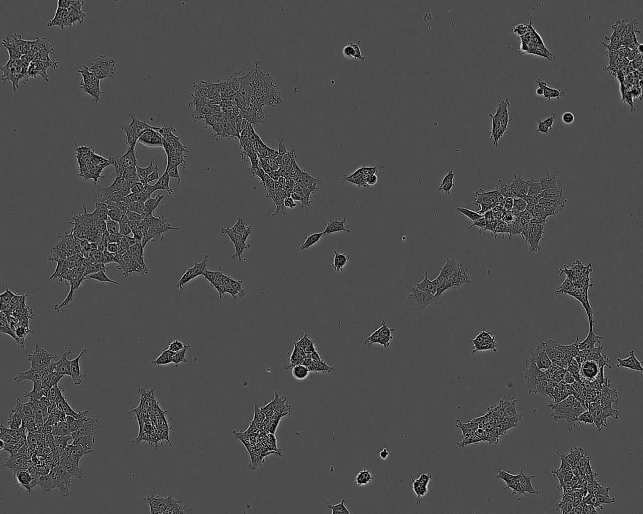 FO [Mouse myeloma]小鼠骨髓瘤复苏细胞(附STR鉴定报告)