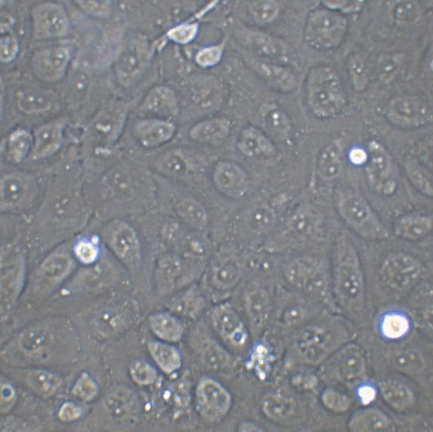 KP-N-RT-BM-1人神经母细胞瘤复苏细胞(附STR鉴定报告)