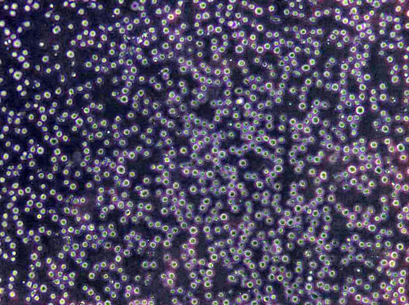 NCI-H1048人小细胞肺癌复苏细胞(附STR鉴定报告)