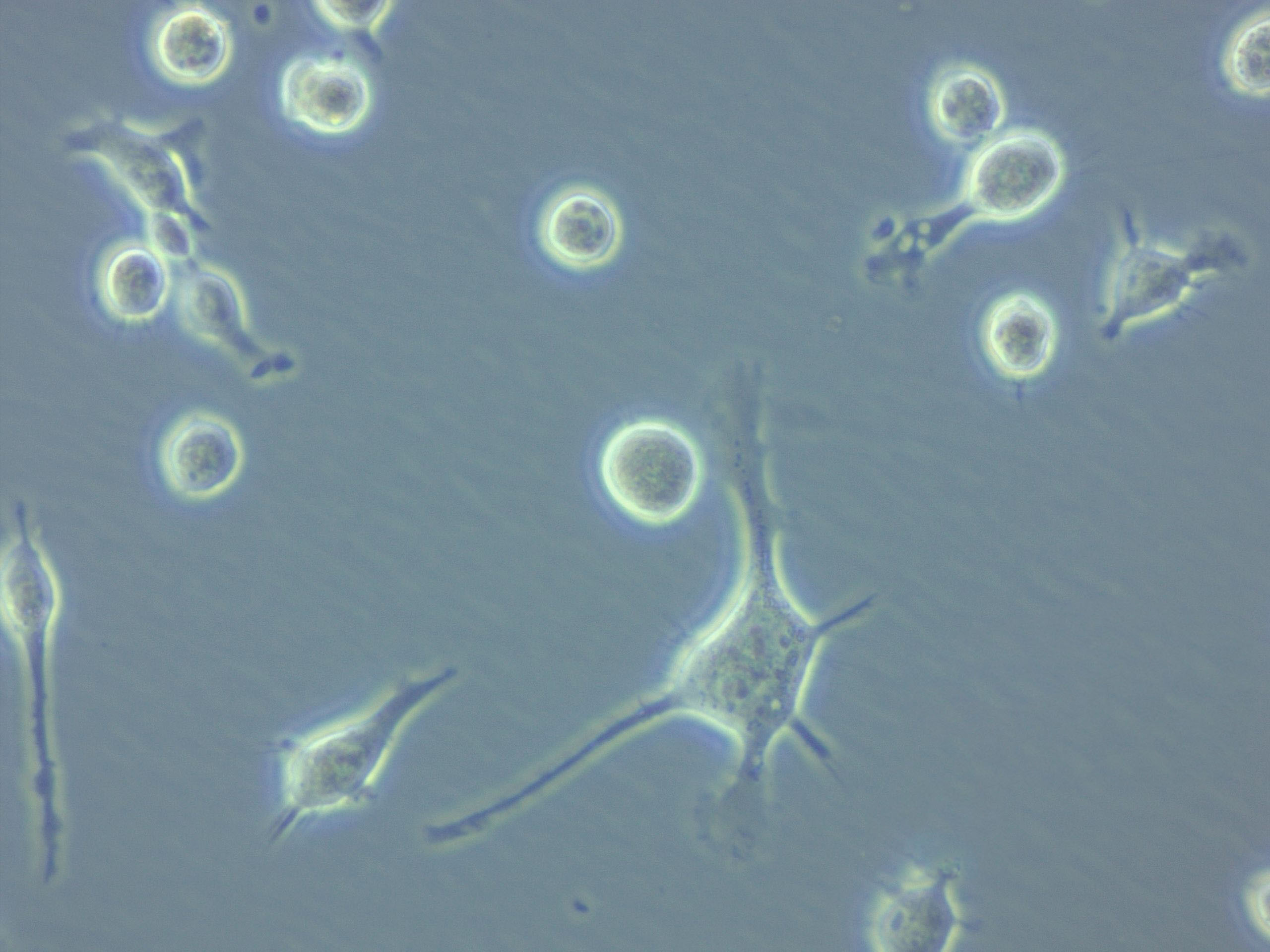 NCI-H1963人小细胞肺癌复苏细胞(附STR鉴定报告)