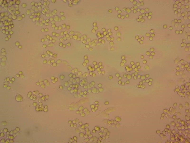滤膜肠球菌琼脂粉末状态培养基