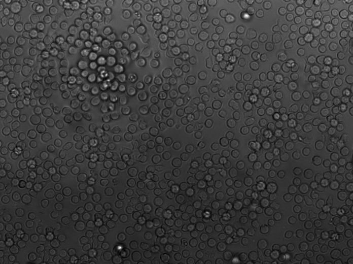 梭状芽孢杆菌计数琼脂粉末状态培养基