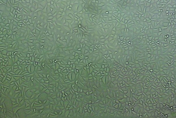 酵母菌形态琼脂固体基础培养基