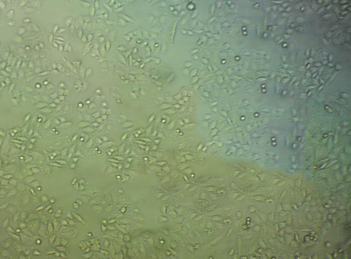 强化梭菌鉴别琼脂固体细粉末培养基