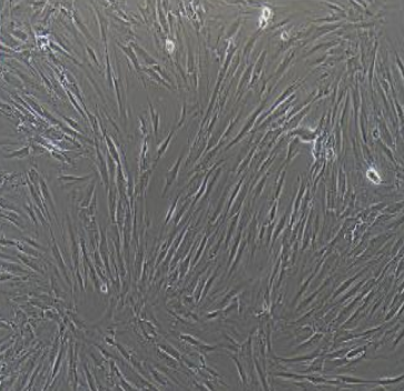 Bel-7404人肝癌细胞